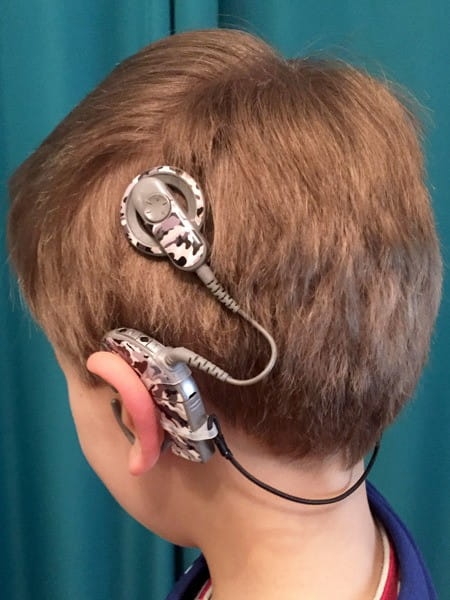 Zawieszka UCHO DO UCHA do procesorów mowy i aparatów słuchowych