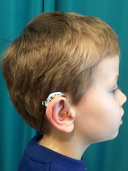 Zawieszka UCHO DO UCHA do procesorów mowy i aparatów słuchowych