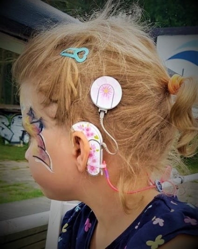 Skórka na procesor Cochlear NUCLEUS 6 - kwiatki