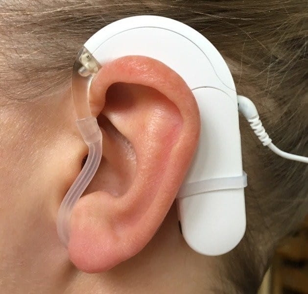 Gumka SmartEar typu `Mic lock`