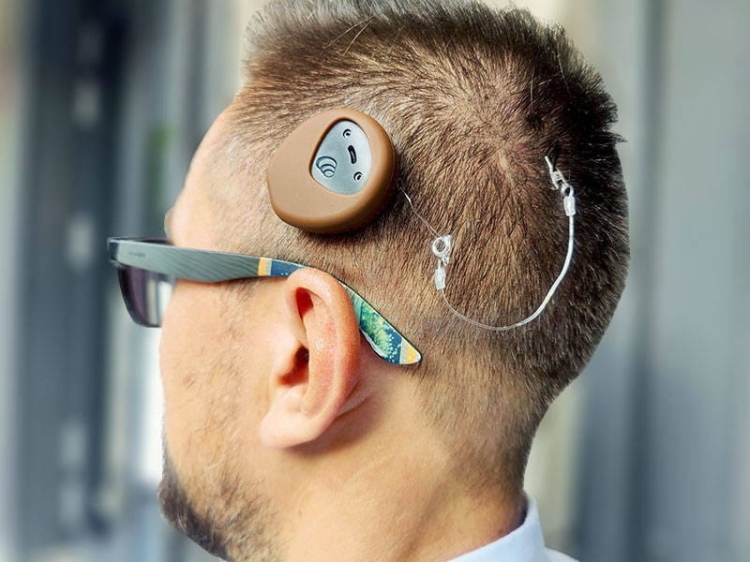 Silikonowe etui ochronne na procesor Cochlear Kanso 2 - czarny
