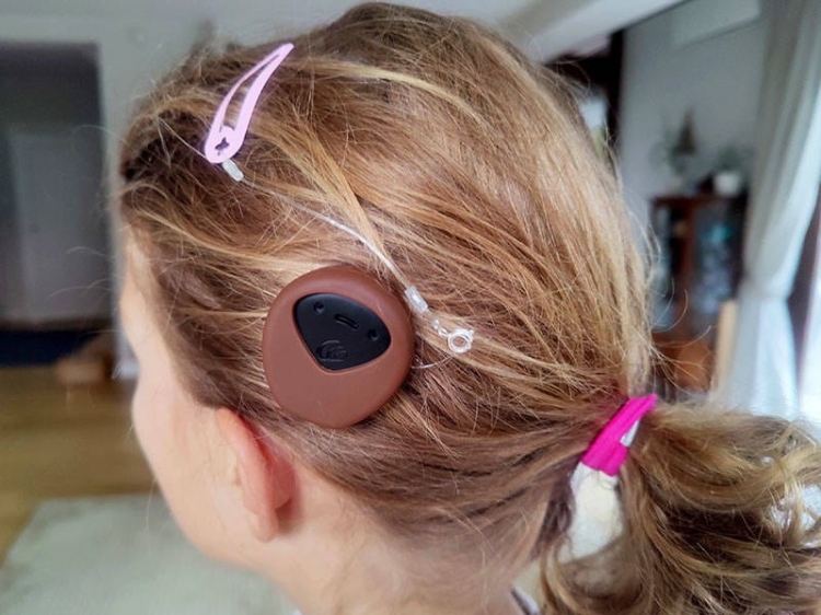 Silikonowe etui ochronne na procesor Cochlear Kanso 2 - beżowy