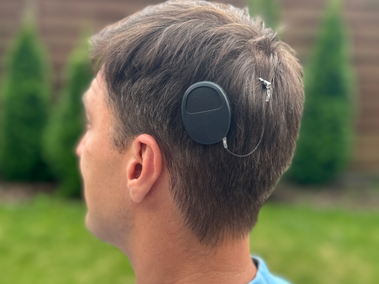 Silikonowe etui ochronne V2 na procesor MED-EL Rondo 3 - czarny