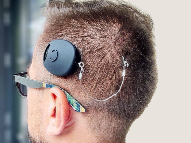 Silikonowe etui ochronne na procesor MED-EL Rondo 2 - czarny