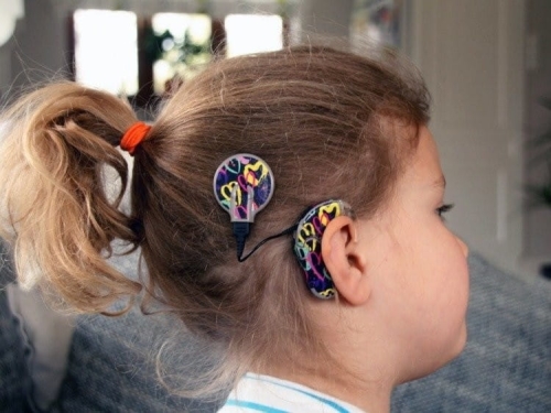 Skórka na procesor Cochlear NUCLEUS 5 - SERCA